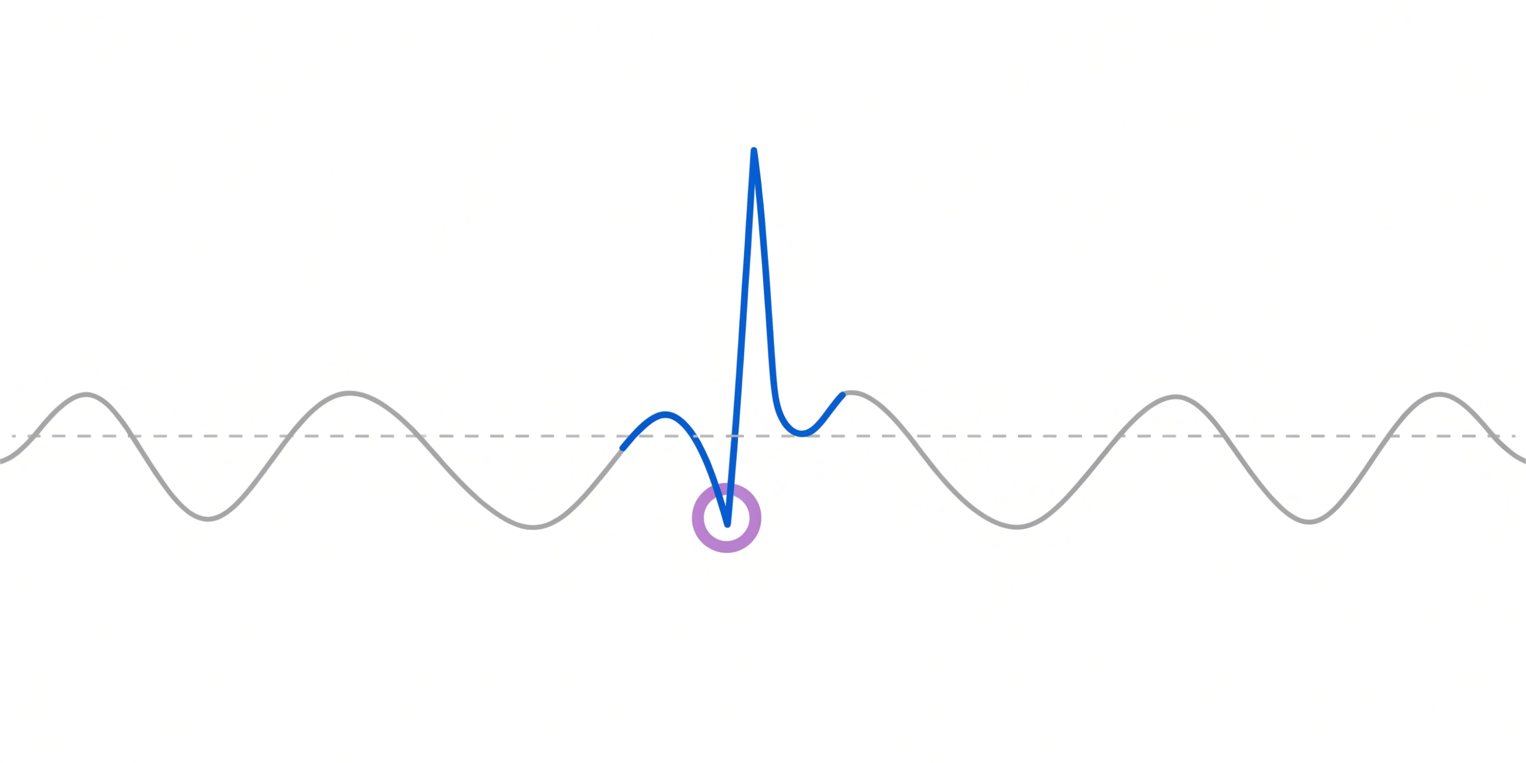 A horizontal metric trend line drawn in soft gray with a highlighted upward spike in blue and a small lavender circular anomaly marker; a dashed horizontal band beneath represents the metric's normal range